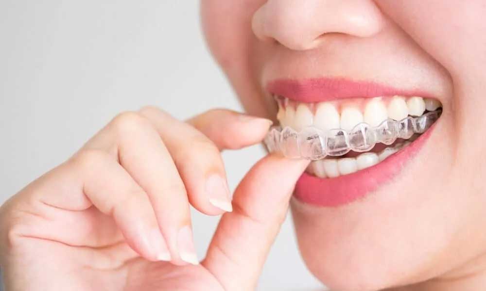 Invisalign is an affordable, high-quality braces system that is virtually invisible.
